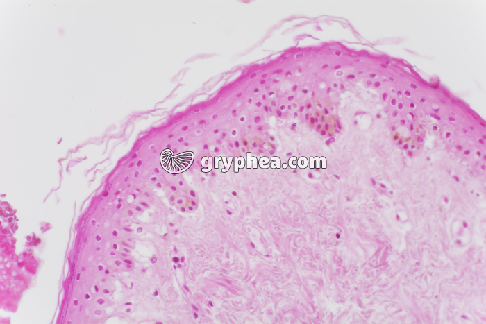 Pénis x100 - gryphea.com